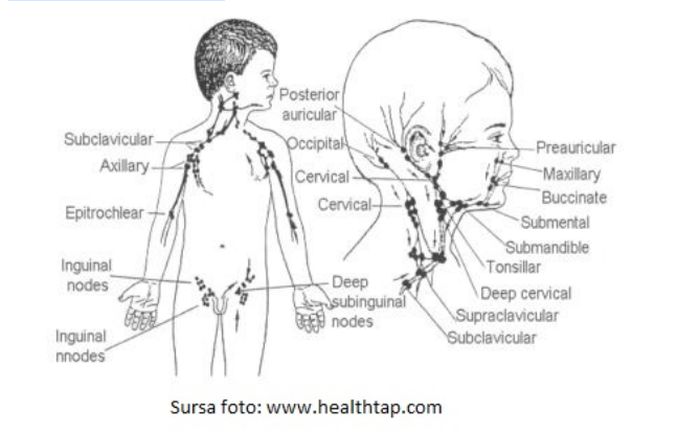 Reumatismul articular acut (RAA) | staru.ro
