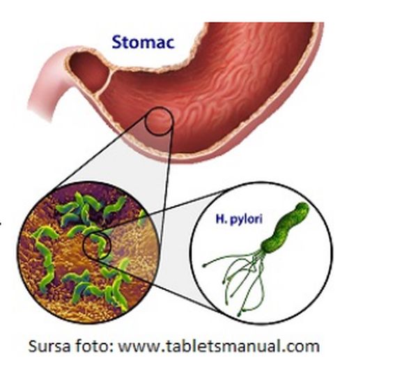 helicobacter pylori scadere in greutate)